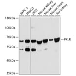 Western Blot - Anti-PKLR Antibody (A90852) - Antibodies.com