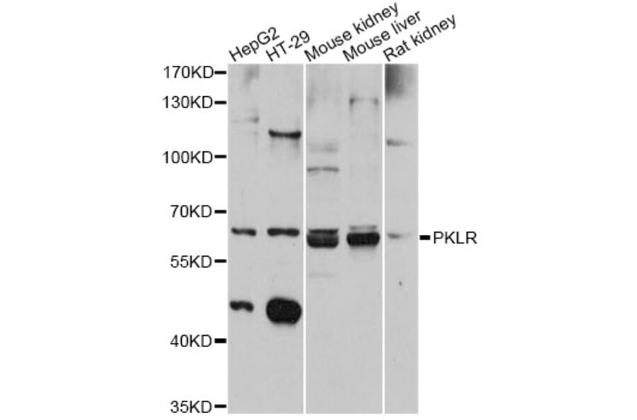 Western Blot - Anti-PKLR Antibody (A12336) - Antibodies.com