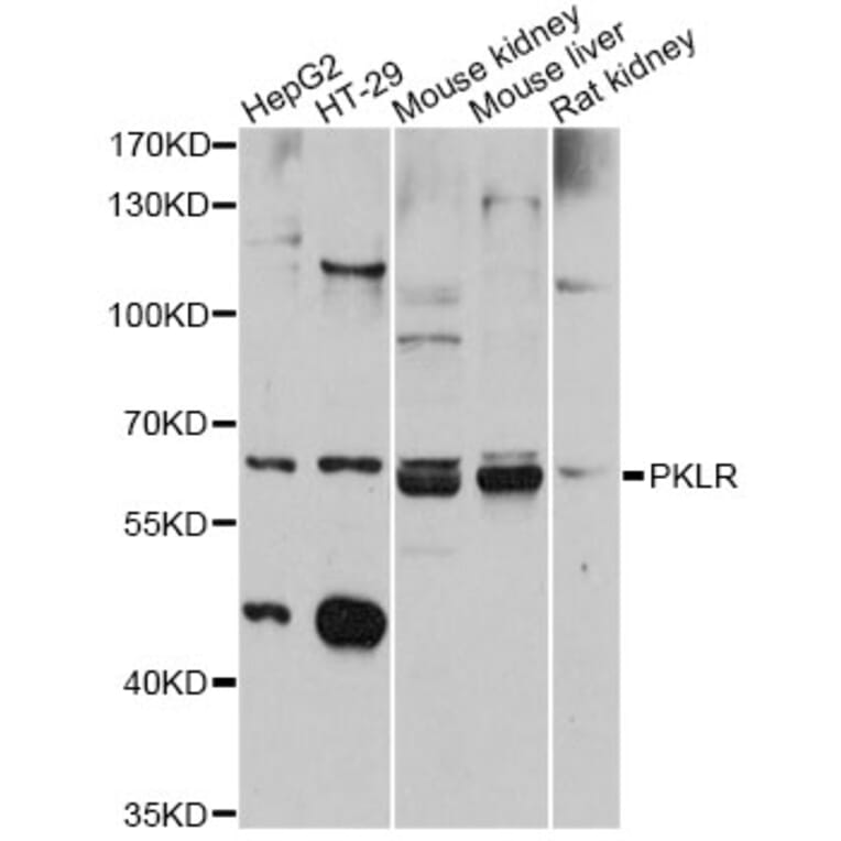 Western Blot - Anti-PKLR Antibody (A12336) - Antibodies.com