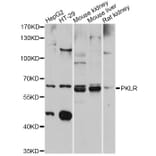Western Blot - Anti-PKLR Antibody (A12336) - Antibodies.com