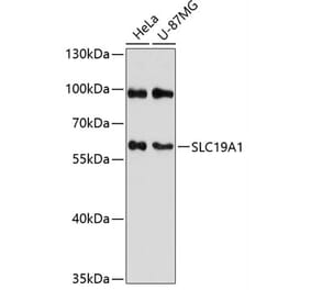 Western Blot - Anti-RFC Antibody (A90854) - Antibodies.com