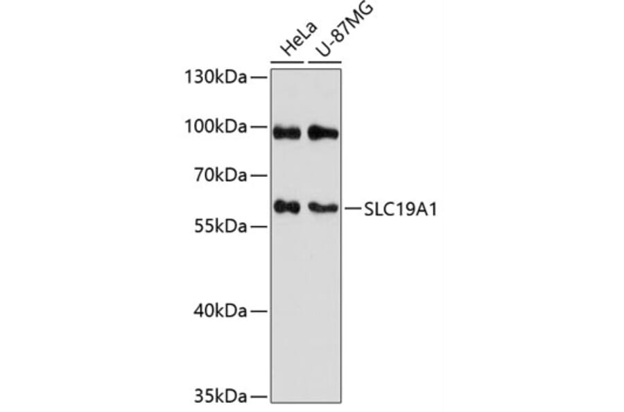 Western Blot - Anti-RFC Antibody (A90854) - Antibodies.com