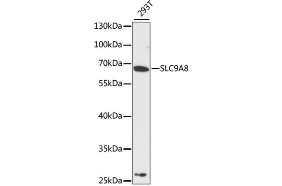 Western Blot - Anti-SLC9A8 Antibody (A12829) - Antibodies.com