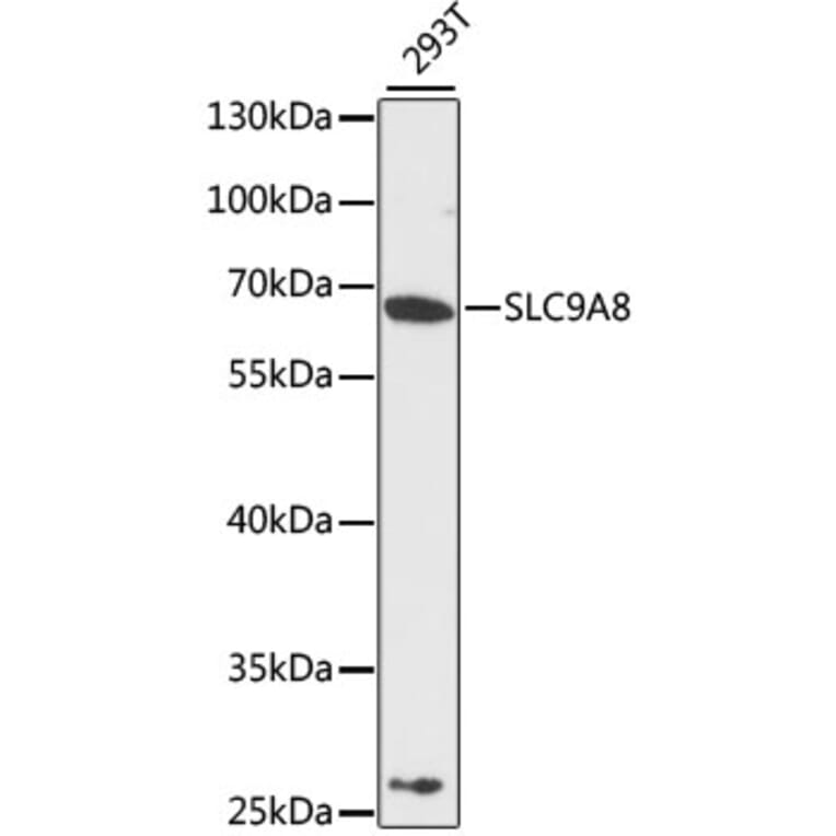 Western Blot - Anti-SLC9A8 Antibody (A12829) - Antibodies.com
