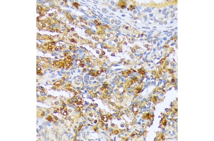 Immunohistochemistry - Anti-A1CF/ACF Antibody (A90856) - Antibodies.com