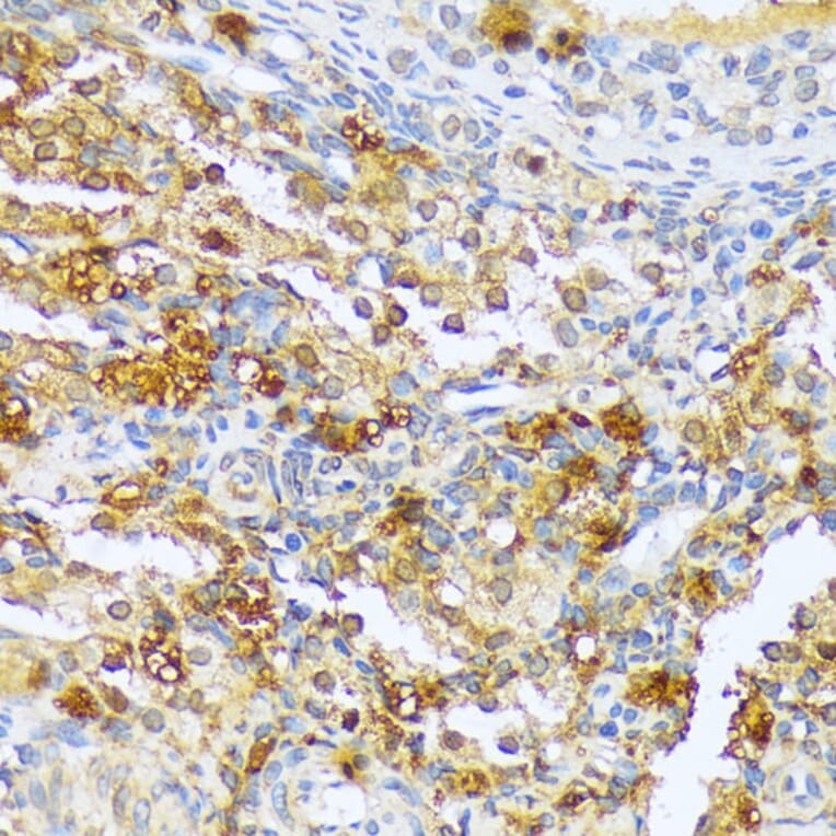 Immunohistochemistry - Anti-A1CF/ACF Antibody (A90856) - Antibodies.com