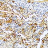 Immunohistochemistry - Anti-A1CF/ACF Antibody (A90856) - Antibodies.com