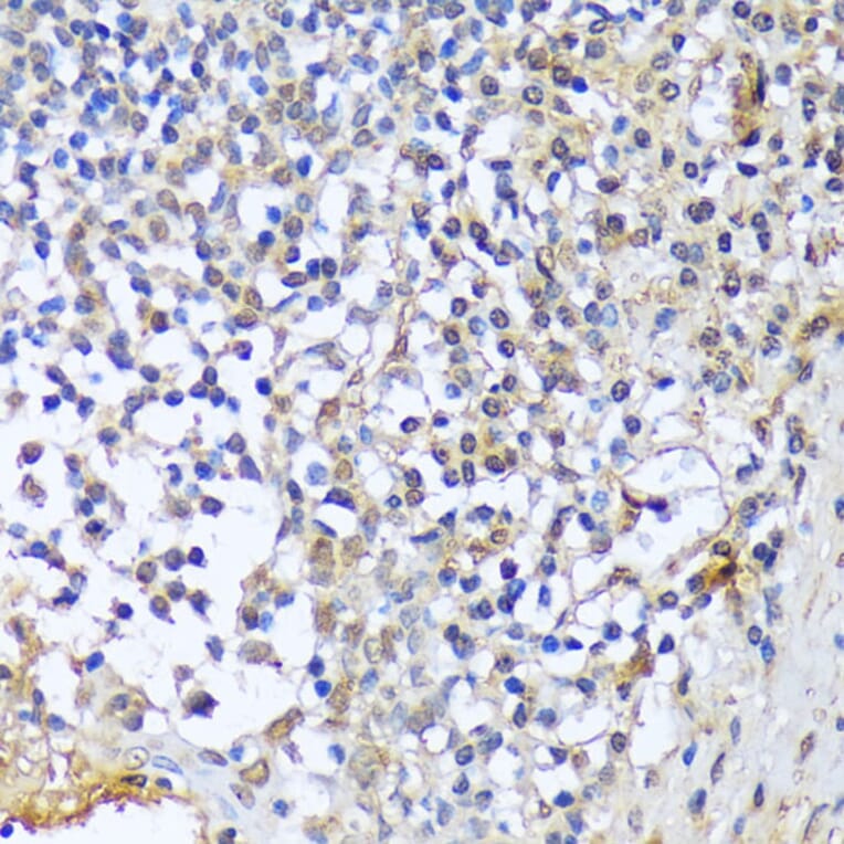Immunohistochemistry - Anti-A1CF/ACF Antibody (A90856) - Antibodies.com