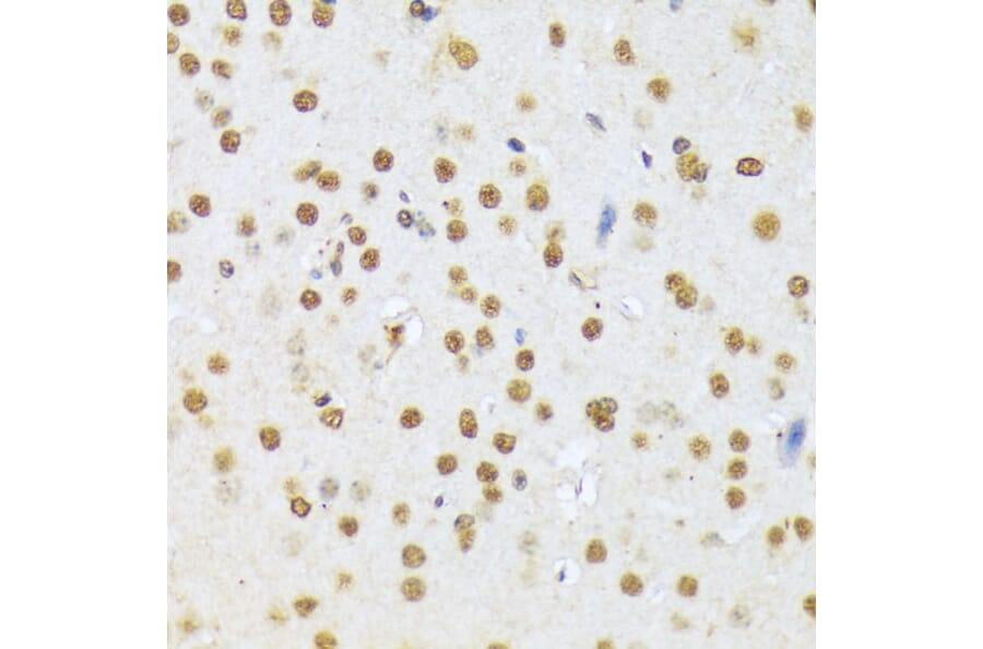 Immunohistochemistry - Anti-A1CF/ACF Antibody (A90856) - Antibodies.com