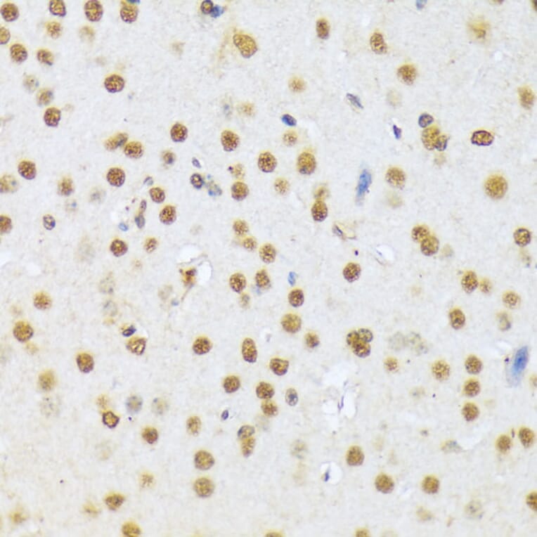 Immunohistochemistry - Anti-A1CF/ACF Antibody (A90856) - Antibodies.com