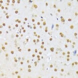 Immunohistochemistry - Anti-A1CF/ACF Antibody (A90856) - Antibodies.com