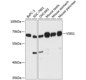 Western Blot - Anti-ChT1 Antibody (A90857) - Antibodies.com