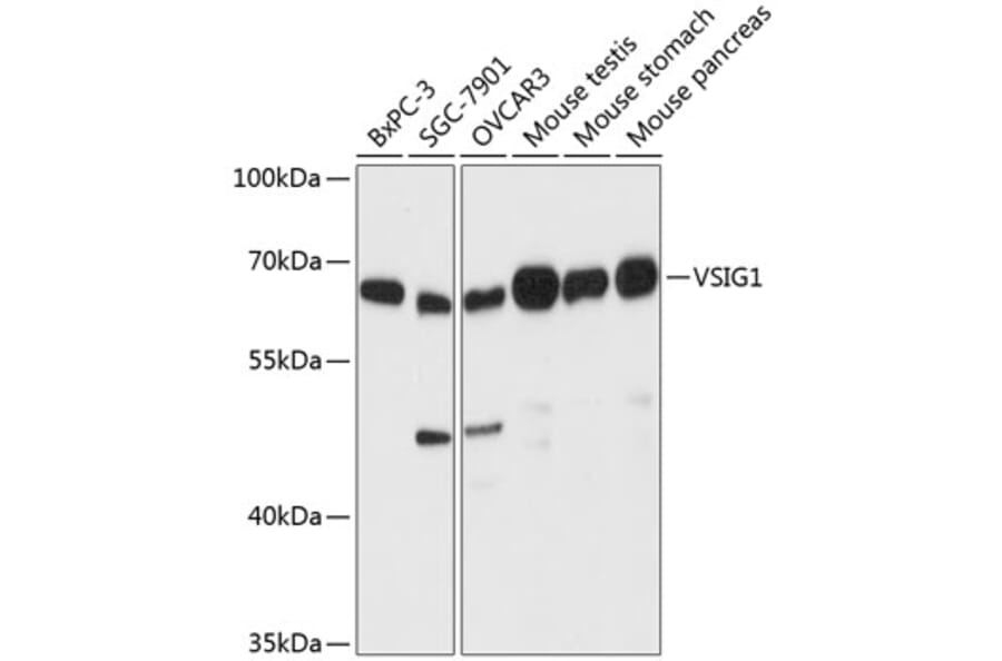 Western Blot - Anti-ChT1 Antibody (A90857) - Antibodies.com