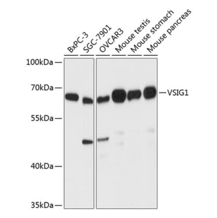 Western Blot - Anti-ChT1 Antibody (A90857) - Antibodies.com