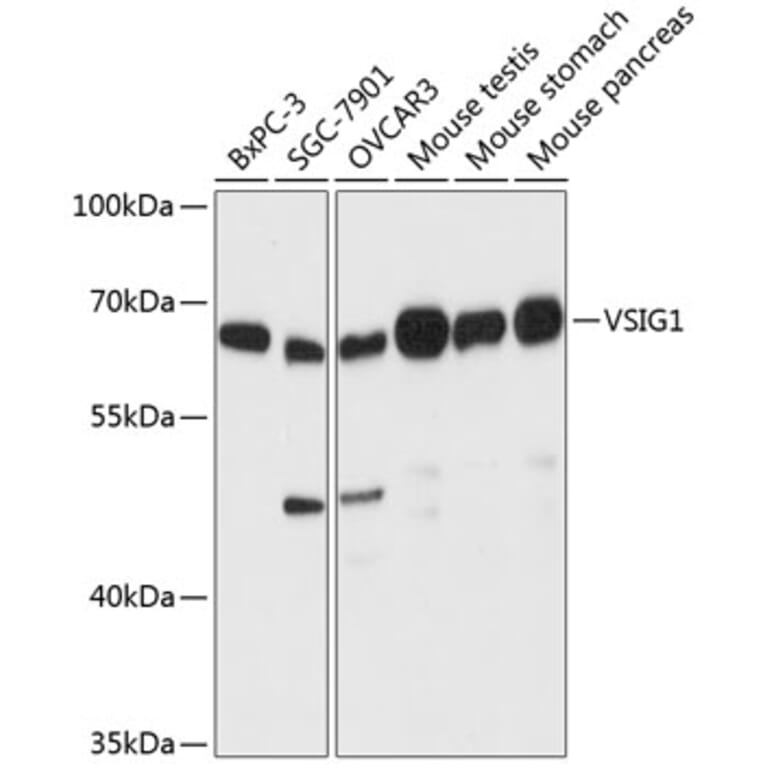 Western Blot - Anti-ChT1 Antibody (A90857) - Antibodies.com