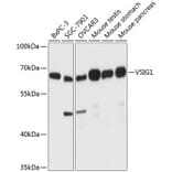 Western Blot - Anti-ChT1 Antibody (A90857) - Antibodies.com