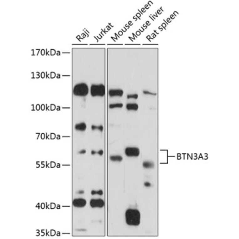 Western Blot - Anti-BTN3A3 Antibody (A90858) - Antibodies.com