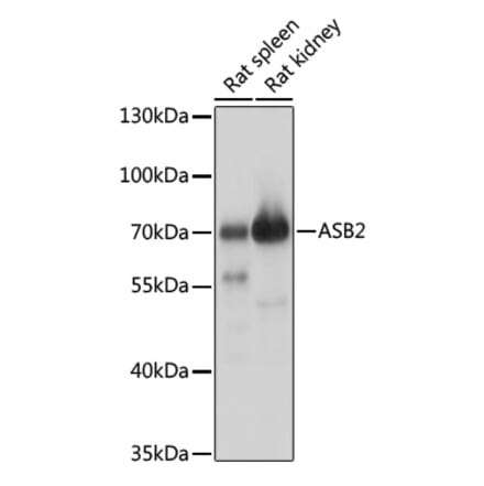 Western Blot - Anti-ASB2 Antibody (A90859) - Antibodies.com