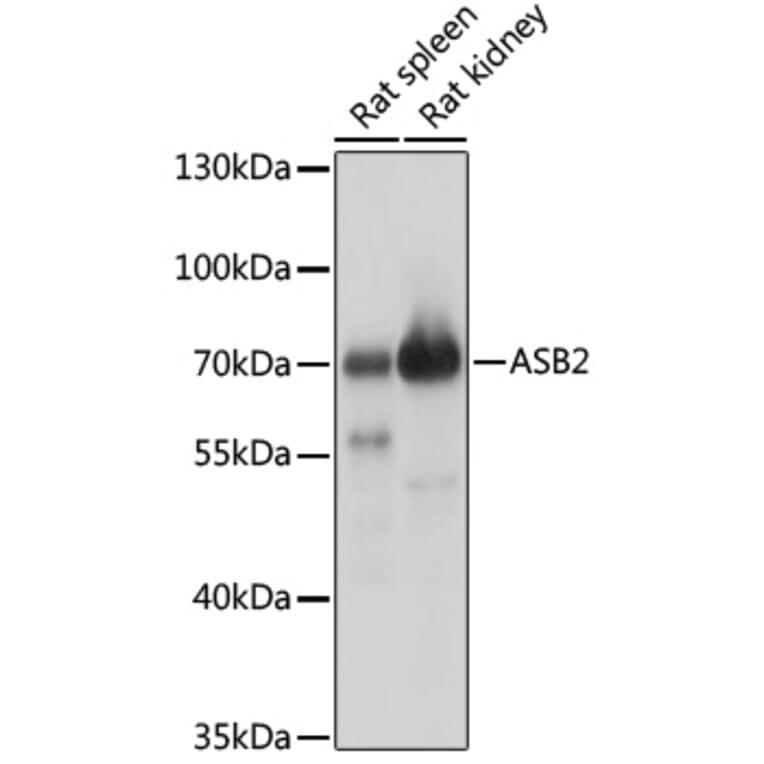 Western Blot - Anti-ASB2 Antibody (A90859) - Antibodies.com