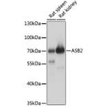 Western Blot - Anti-ASB2 Antibody (A90859) - Antibodies.com