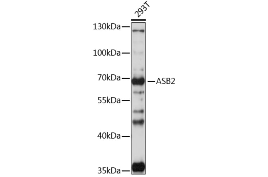 Western Blot - Anti-ASB2 Antibody (A90859) - Antibodies.com