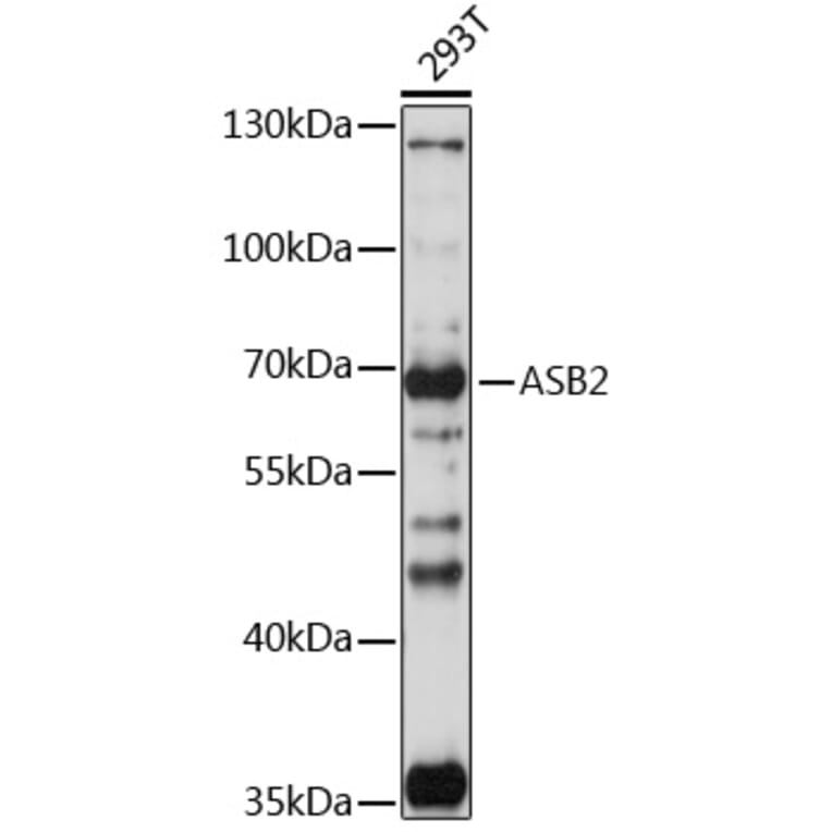 Western Blot - Anti-ASB2 Antibody (A90859) - Antibodies.com