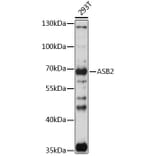 Western Blot - Anti-ASB2 Antibody (A90859) - Antibodies.com