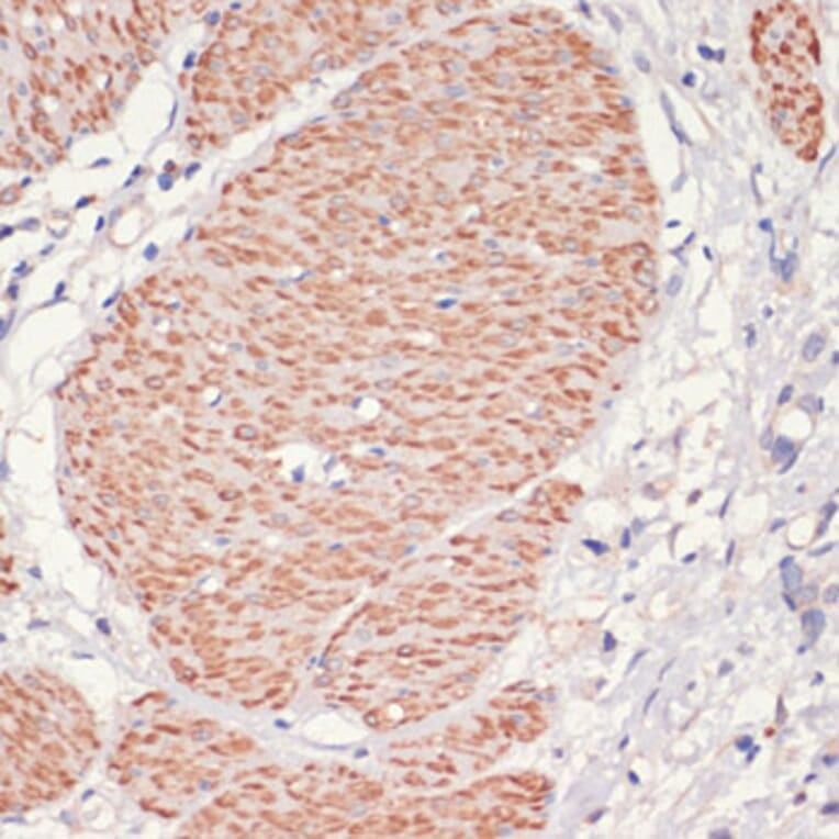 Immunohistochemistry - Anti-AMPK alpha 1 Antibody (A90860) - Antibodies.com