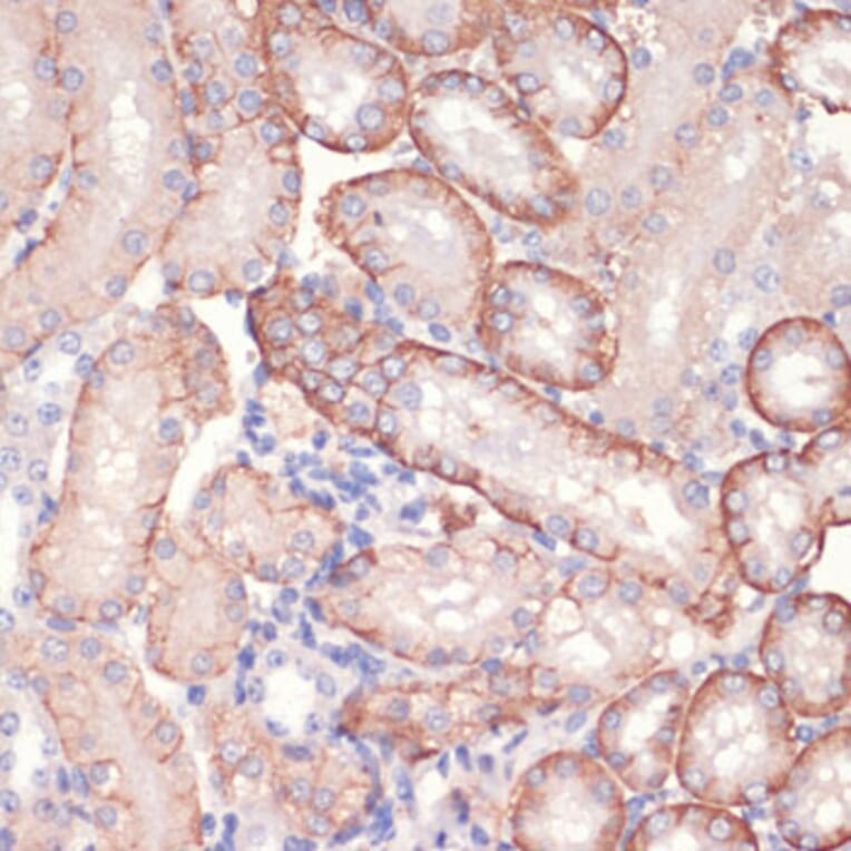 Immunohistochemistry - Anti-AMPK alpha 1 Antibody (A90860) - Antibodies.com