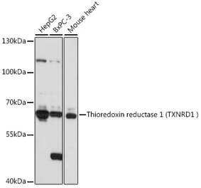 Western Blot - Anti-TXNRD1 Antibody (A90861) - Antibodies.com