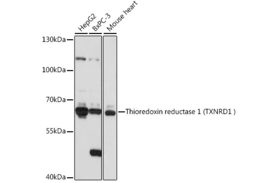 Western Blot - Anti-TXNRD1 Antibody (A90861) - Antibodies.com