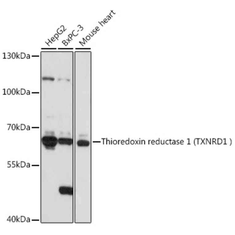 Western Blot - Anti-TXNRD1 Antibody (A90861) - Antibodies.com