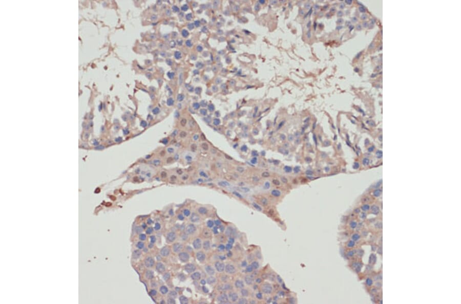 Immunohistochemistry - Anti-TXNRD1 Antibody (A90861) - Antibodies.com