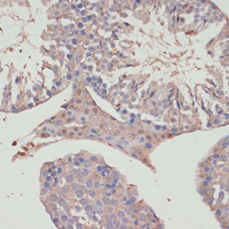 Immunohistochemistry - Anti-TXNRD1 Antibody (A90861) - Antibodies.com