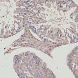 Immunohistochemistry - Anti-TXNRD1 Antibody (A90861) - Antibodies.com