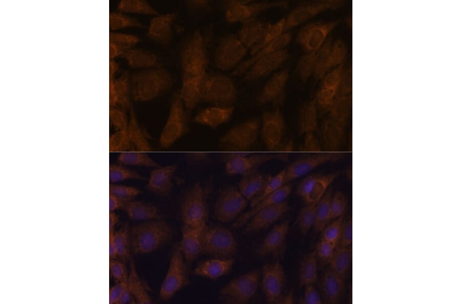 Immunofluorescence - Anti-TXNRD1 Antibody (A90861) - Antibodies.com