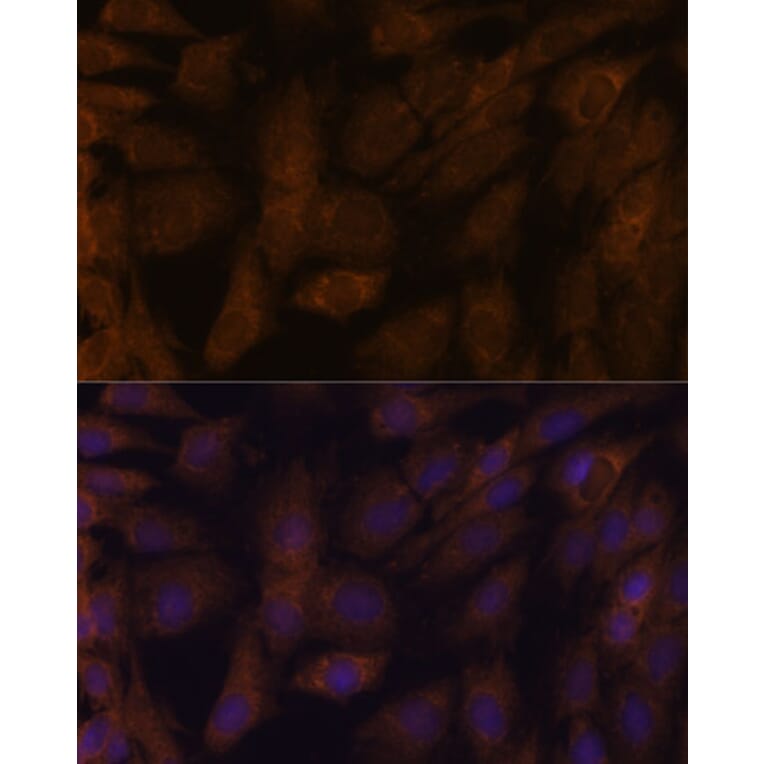 Immunofluorescence - Anti-TXNRD1 Antibody (A90861) - Antibodies.com