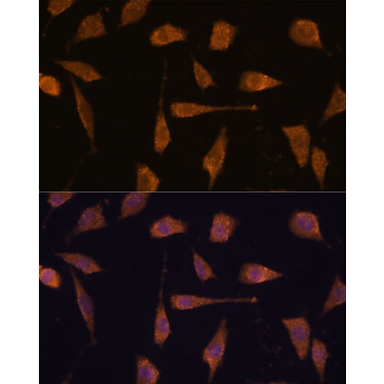 Immunofluorescence - Anti-TXNRD1 Antibody (A90861) - Antibodies.com