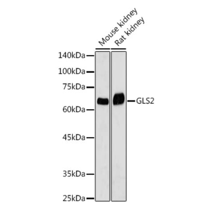 Western Blot - Anti-GLS2 Antibody (A90862) - Antibodies.com