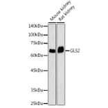 Western Blot - Anti-GLS2 Antibody (A90862) - Antibodies.com