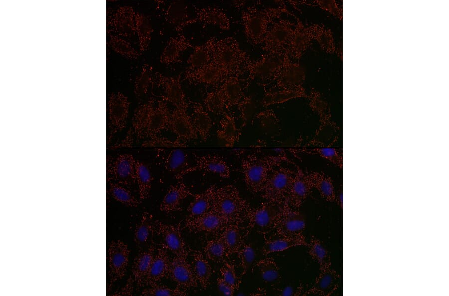 Immunofluorescence - Anti-GLS2 Antibody (A90862) - Antibodies.com