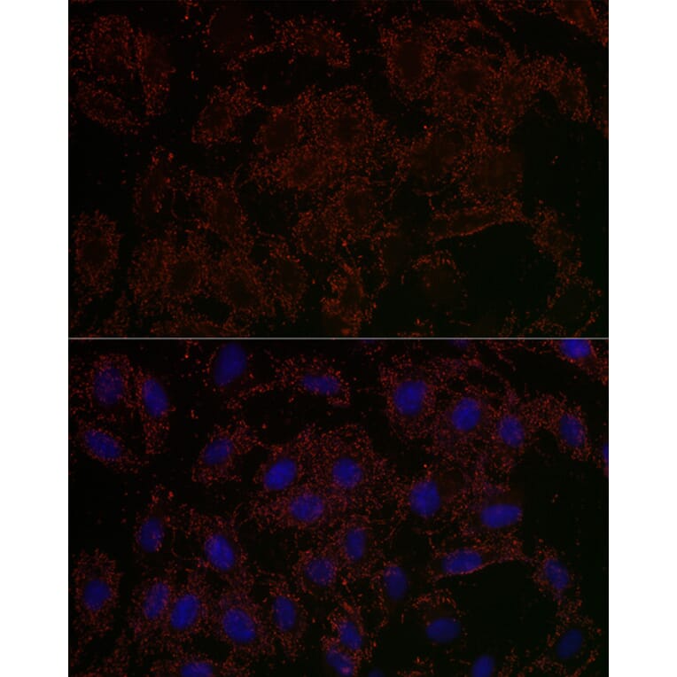 Immunofluorescence - Anti-GLS2 Antibody (A90862) - Antibodies.com