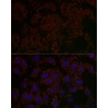 Immunofluorescence - Anti-GLS2 Antibody (A90862) - Antibodies.com