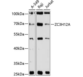 Western Blot - Anti-MCPIP1 Antibody (A90863) - Antibodies.com