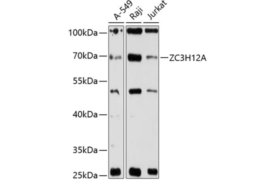 Western Blot - Anti-MCPIP1 Antibody (A90863) - Antibodies.com