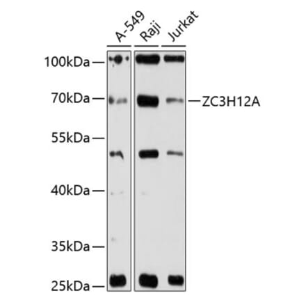 Western Blot - Anti-MCPIP1 Antibody (A90863) - Antibodies.com