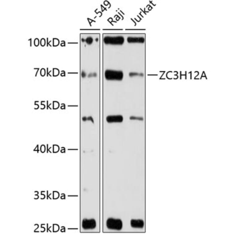 Western Blot - Anti-MCPIP1 Antibody (A90863) - Antibodies.com