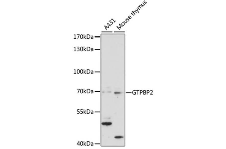 Western Blot - Anti-GTPBP2 Antibody (A90864) - Antibodies.com