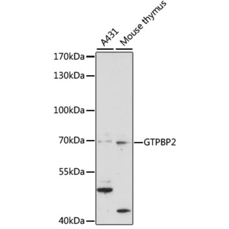 Western Blot - Anti-GTPBP2 Antibody (A90864) - Antibodies.com