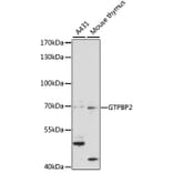 Western Blot - Anti-GTPBP2 Antibody (A90864) - Antibodies.com